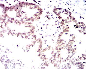 CDKN2B Rabbit Polyclonal Antibody