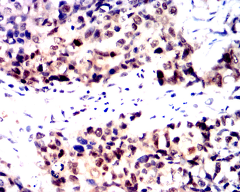 CDKN2B Rabbit Polyclonal Antibody