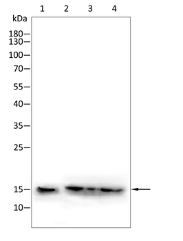 CDKN2B Rabbit Polyclonal Antibody