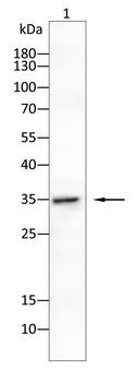 ACP5 Antibody