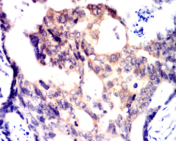SST Antibody