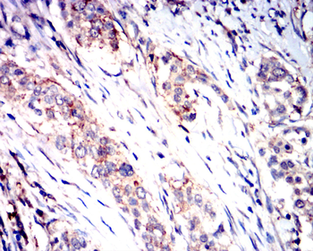 DDR2 Antibody