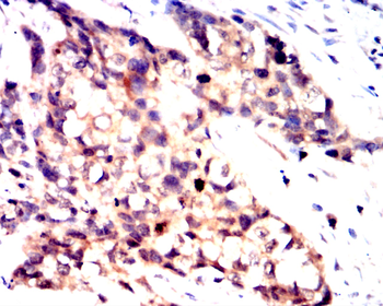 RICTOR Antibody
