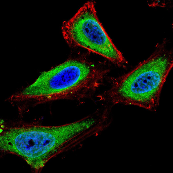 MMP13 Rabbit Polyclonal Antibody