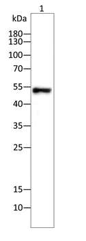 MMP13 Rabbit Polyclonal Antibody