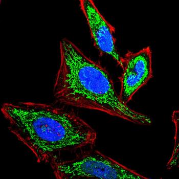 CDKN2B Rabbit Polyclonal Antibody