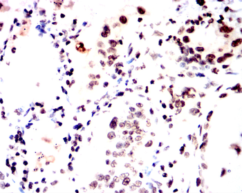 CDKN2B Rabbit Polyclonal Antibody