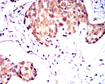 GSK3B Antibody