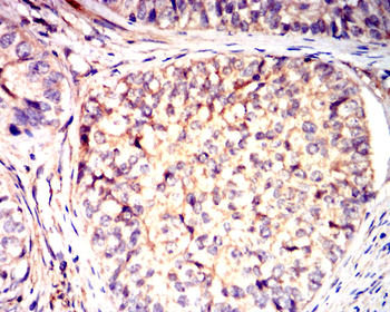NME1 Antibody