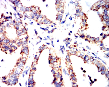 ALDH2 Antibody