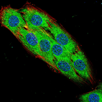 PCSK9 Antibody