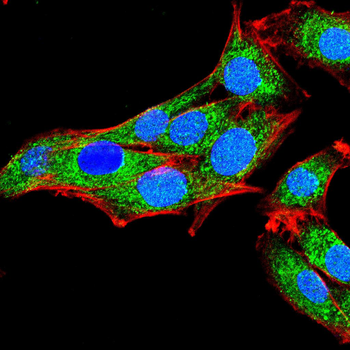 ITGB1 Antibody