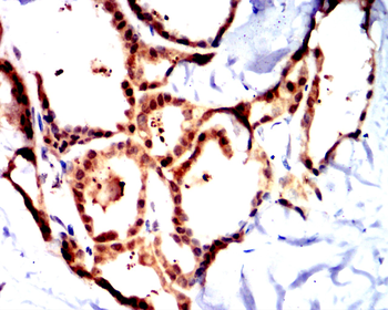 GSTP1 Antibody