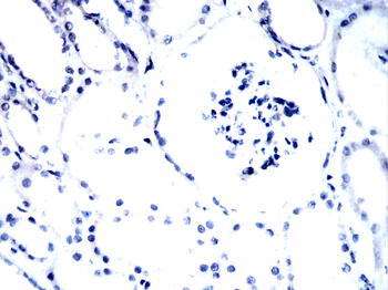 Hemgglutinin Gene Antibody
