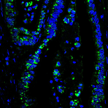 ATF6 Antibody