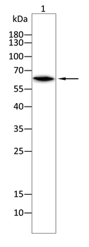 IFNAR1 Rabbit Polyclonal Antibody