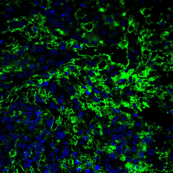 PTEN Antibody