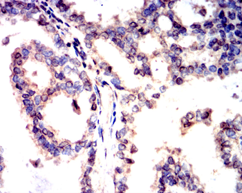 PTEN Antibody