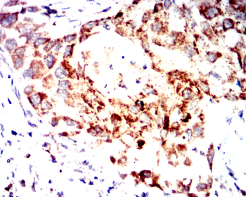 TSPO Antibody