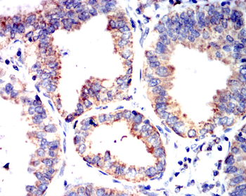 TSPO Antibody