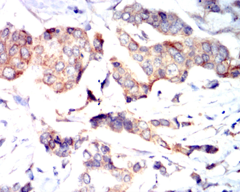 COL6A1 Antibody