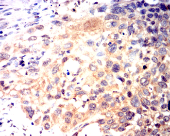 VEGFA Antibody