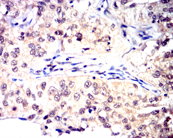 MAPK14 Antibody