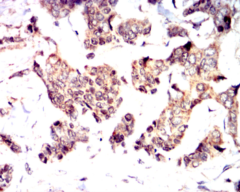 TP53 Antibody