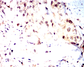 TP53 Antibody