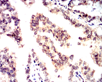 TP53 Antibody