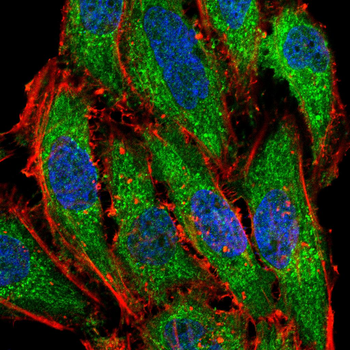 ACACA Antibody