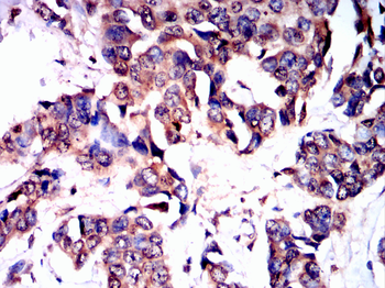 ACACA Antibody