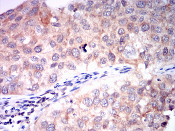 ACACA Antibody