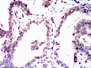 ACACA Antibody