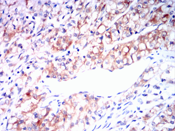 ACACA Antibody