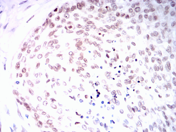 CCNE1 Antibody