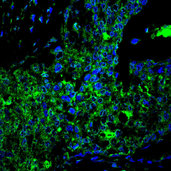 MUC1 Antibody
