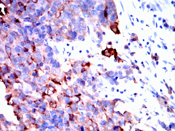 MUC1 Antibody