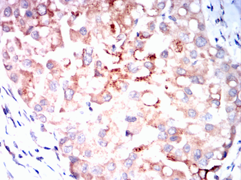 TXNIP Antibody