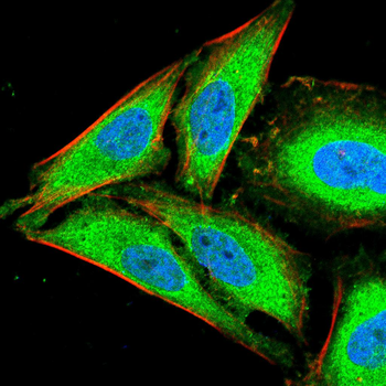 AIF Rabbit Polyclonal Antibody