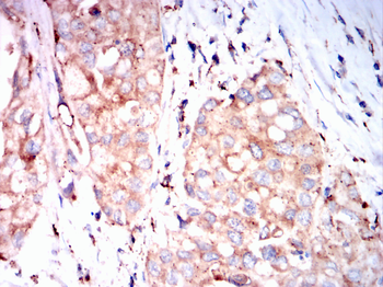 CTSD Antibody