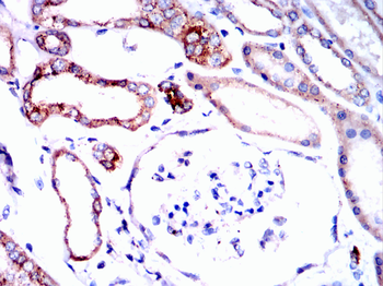 CTSD Antibody