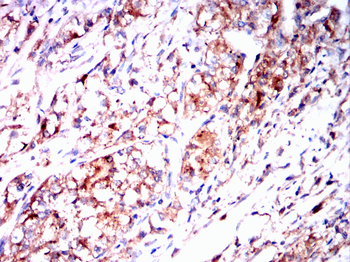 CTSD Antibody