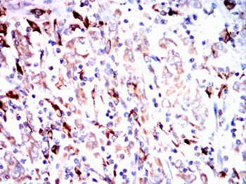 CTSD Antibody