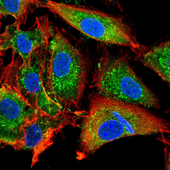ALB Antibody