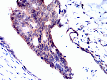 RB1 Antibody