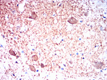 ENO2 Antibody
