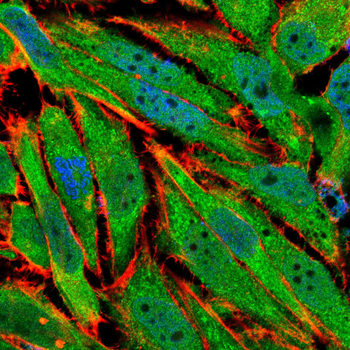 BRAF Antibody