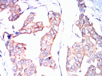 BRAF Antibody