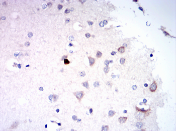 PSD95 Rabbit Polyclonal Antibody